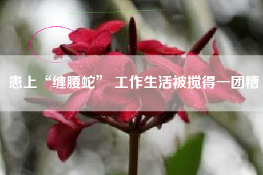 患上“缠腰蛇” 工作生活被搅得一团糟
